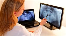 curso traumatismos dentales en la infancia, diagnostico y terapéutica