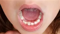 ##IMAGE##