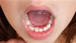 ##IMAGE##