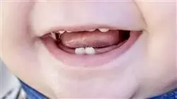 ##IMAGE##