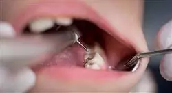 diplomado online odontología en pacientes pediátricos con necesidades especiales