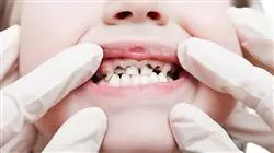 ##IMAGE##