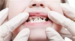 curso odontología pediátrica preventiva y caries dental