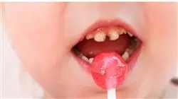 posgrado odontologia pediatrica preventiva caries dental