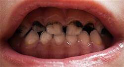 posgrado odontología pediátrica preventiva y caries dental