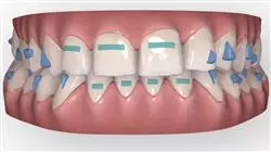 cursos ortodoncia transparente avanzada