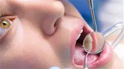 especializacion online ortodoncia transparente avanzada