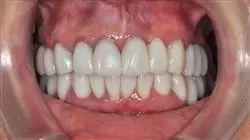 ##IMAGE##