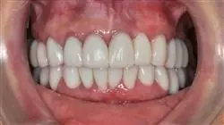 ##IMAGE##