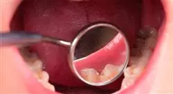 diplomado online introducción a la ortopedia dentofacial