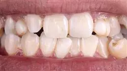 ##IMAGE##