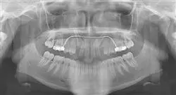 grand master ortodoncia y ortopedia dentofacial
