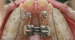 master online ortodoncia y ortopedia dentofacial