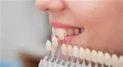 diplomado online utilización de porcelanas en odontología