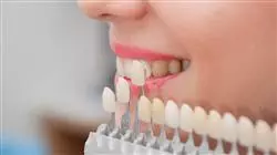 ##IMAGE##
