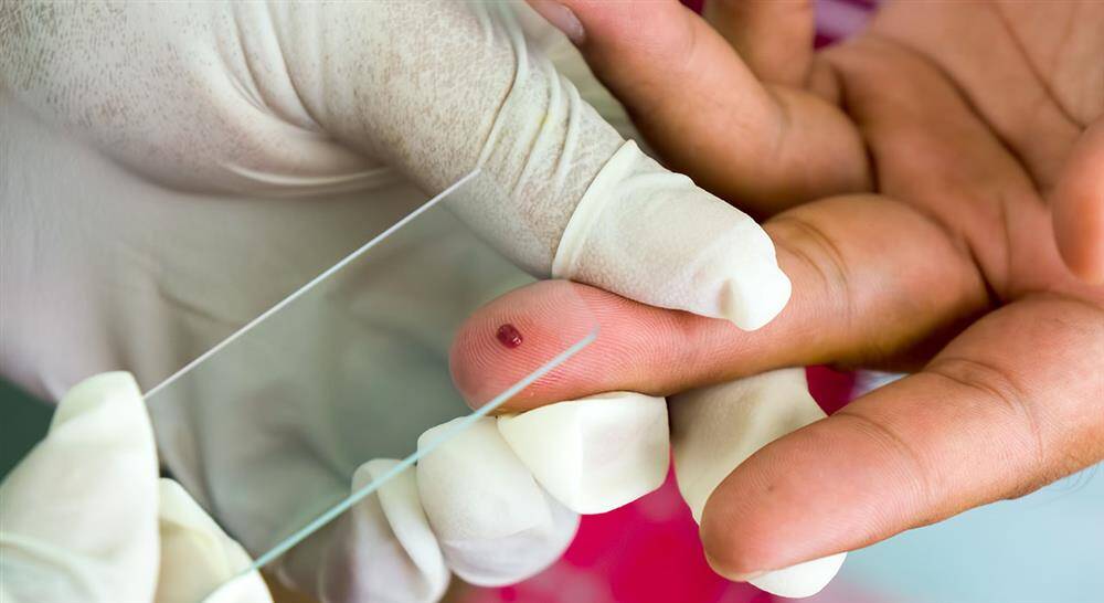 curso enfermedades infecciosas Tech Universidad