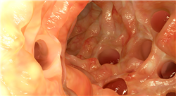 formacion nutrición en patologías del aparato digestivo para farmacéuticos