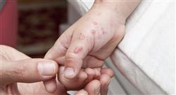 curso infecciones adquiridas en la comunidad para farmacéuticos