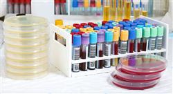 diplomado infecciones adquiridas en la comunidad para farmacéuticos
