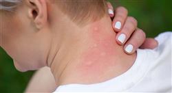 diplomado infecciones emergentes reemergentes e importadas para farmacéuticos