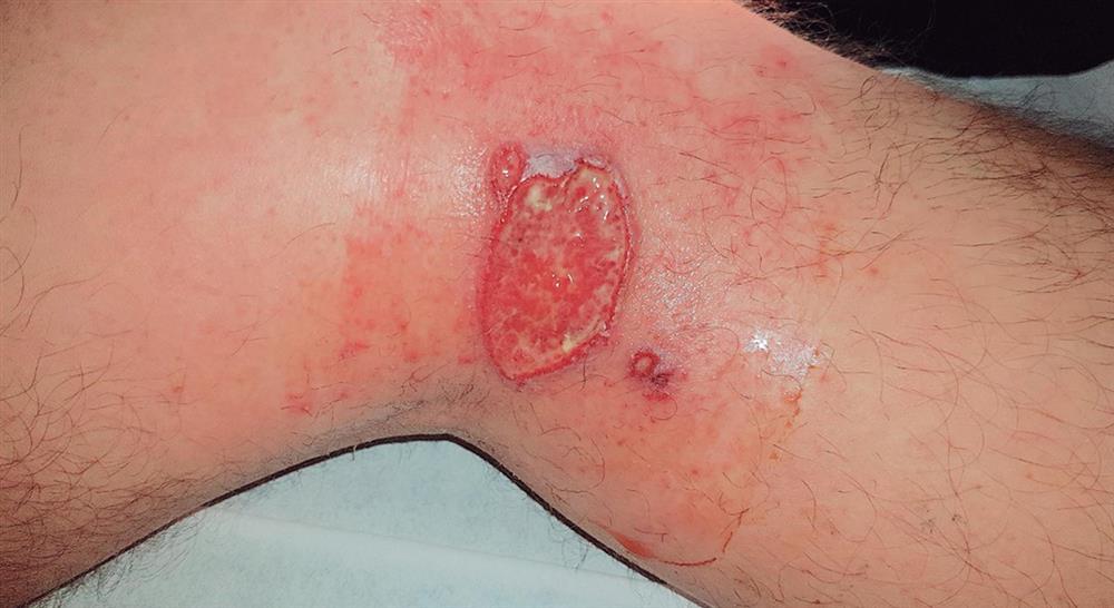 formacion diagnostico microbiologico clinico enfermedades