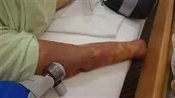##IMAGE##