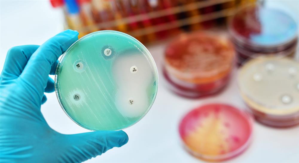 curso control infeccion huesped inmunodeprimido