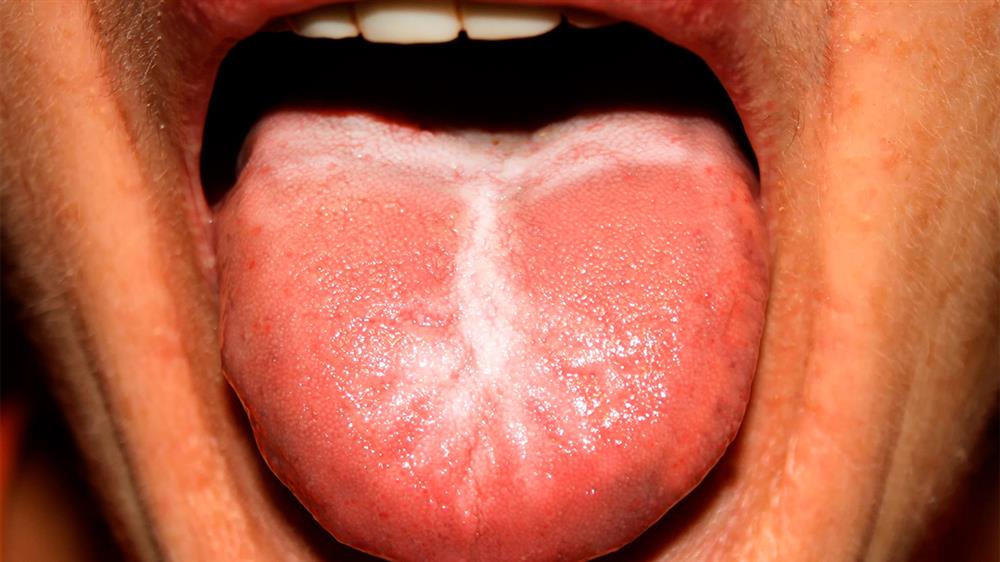 diplomado control infeccion huesped inmunodeprimido