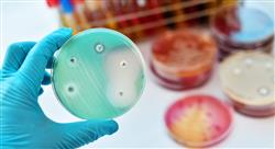 curso control infeccion huesped inmunodeprimido