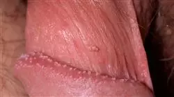 ##IMAGE##