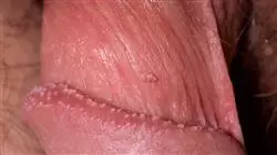 ##IMAGE##