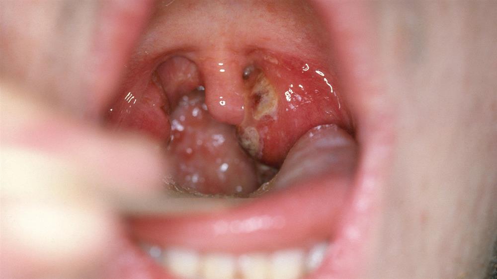 formacion diagnostico tratamiento infeccion causada virus