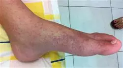 ##IMAGE##