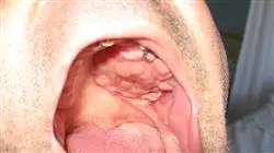 ##IMAGE##