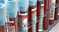diplomado diagnostico tratamiento infeccion vih sida farmaceuticos