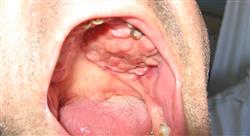 estudiar diagnostico tratamiento infeccion vih sida farmaceuticos