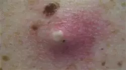 ##IMAGE##