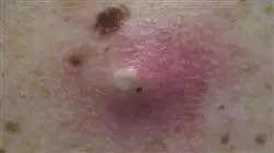 ##IMAGE##