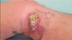 ##IMAGE##