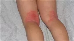 ##IMAGE##