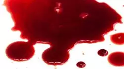 ##IMAGE##