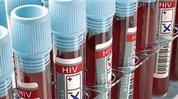 diplomado online hepatitis tuberculosis infeccion vih sida