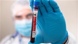 especializacion online infectologia clinica enfermedades transmitidas via sanguinea farm