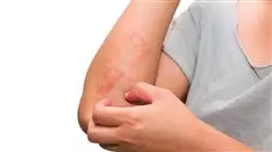 ##IMAGE##