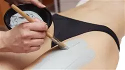 ##IMAGE##
