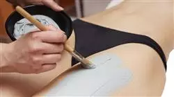 ##IMAGE##