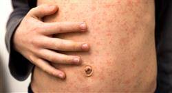 a prevencion tratamiento infecciones relacionadas