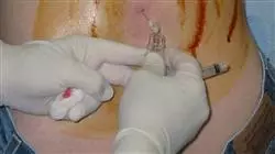 ##IMAGE##