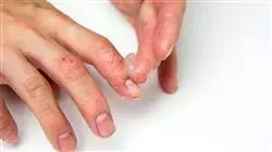 ##IMAGE##