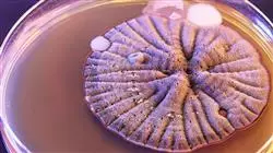 diplomado online bacterias multirresistentes patologia humana